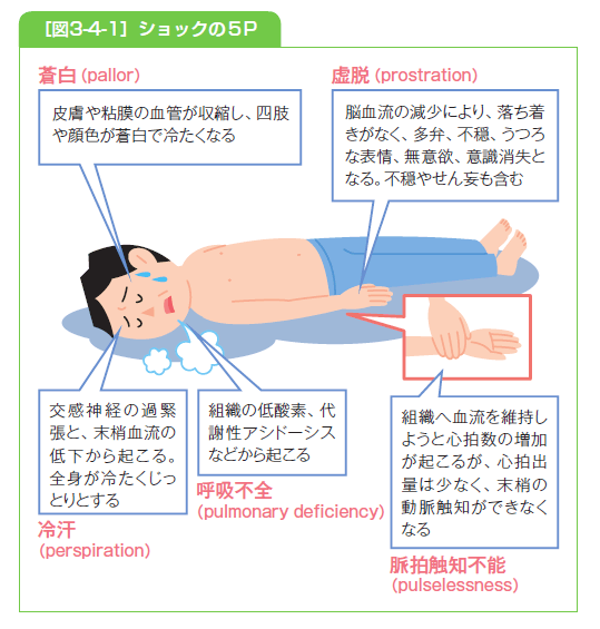 ショック 観察項目: ショック ガイドライン – FSNUGF