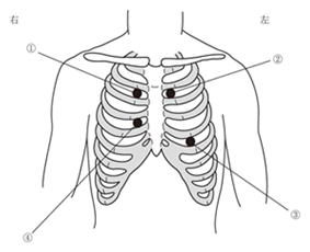 成人の心音の聴取部位