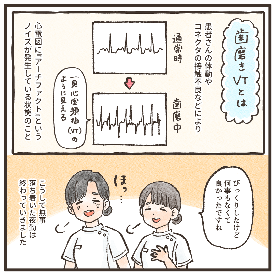 歯磨きVTとは心電図波形のアーチフェクトのこと。看護師はほっと胸をなでおろした