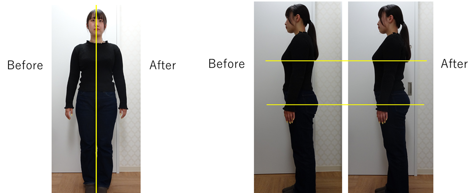before-after