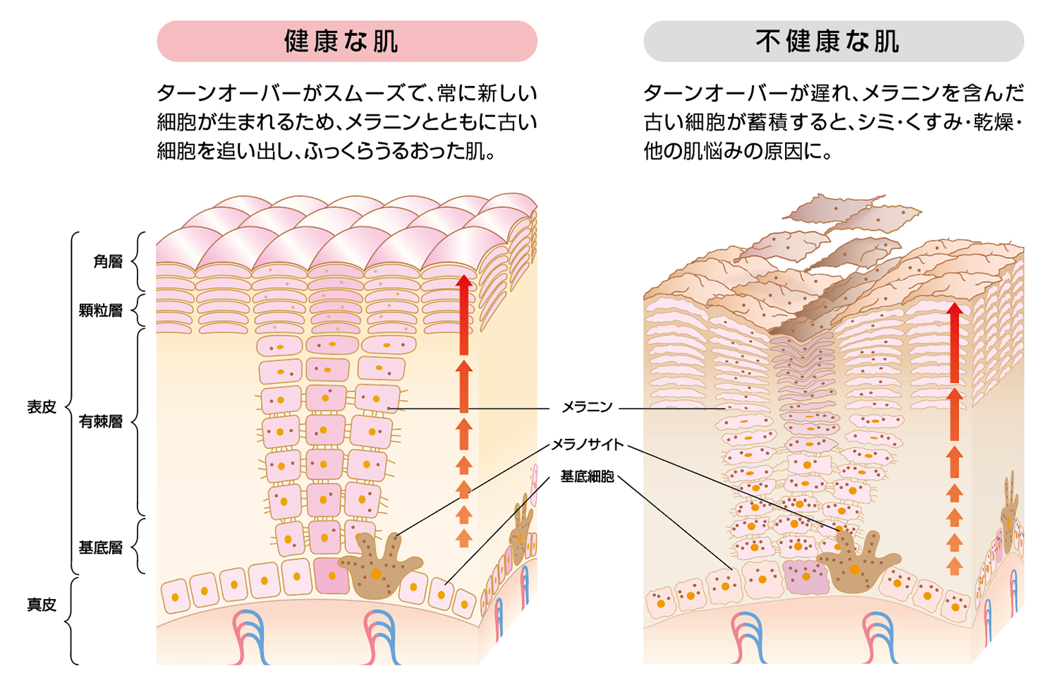 肌のキメ