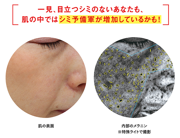 内部のメラニン