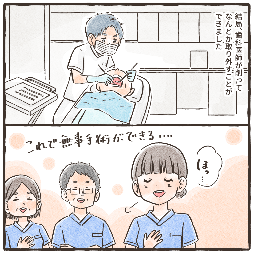 結局、歯科医師が削って取り外すことができてほっとした