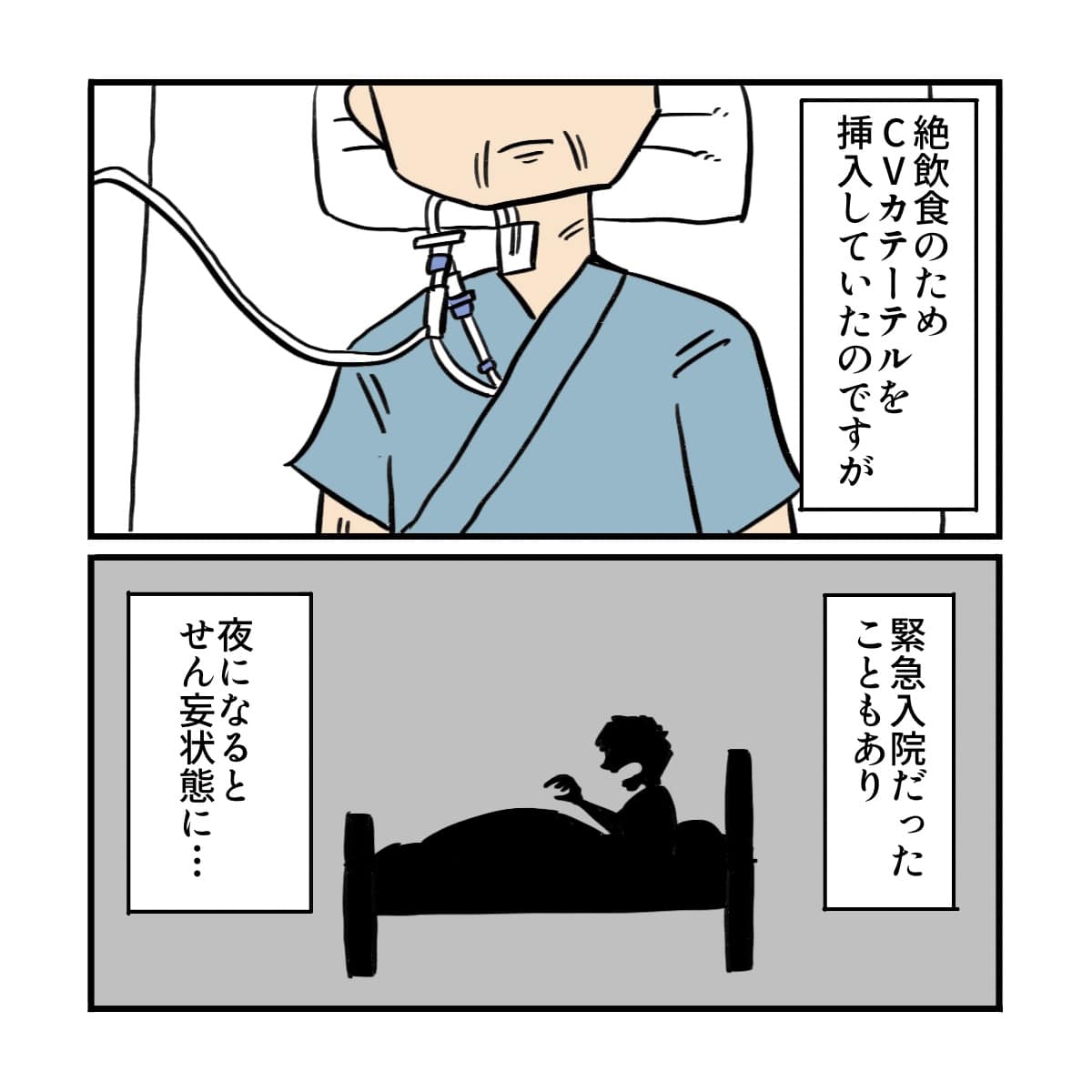 絶飲食でCVカテーテルを入れていた