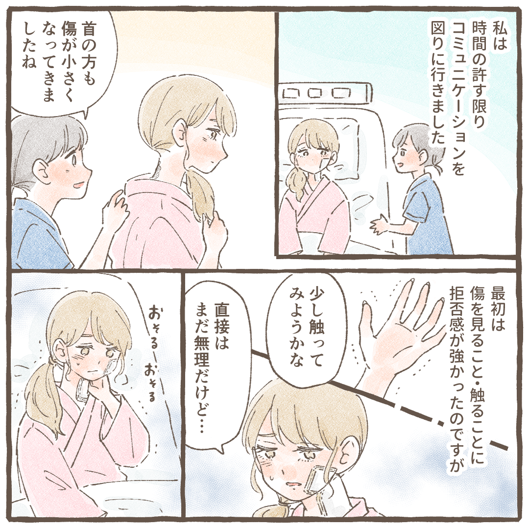 看護師はコミュニケーションを良く取り、次第に熱傷の傷にも自分で触れることができるようになった
