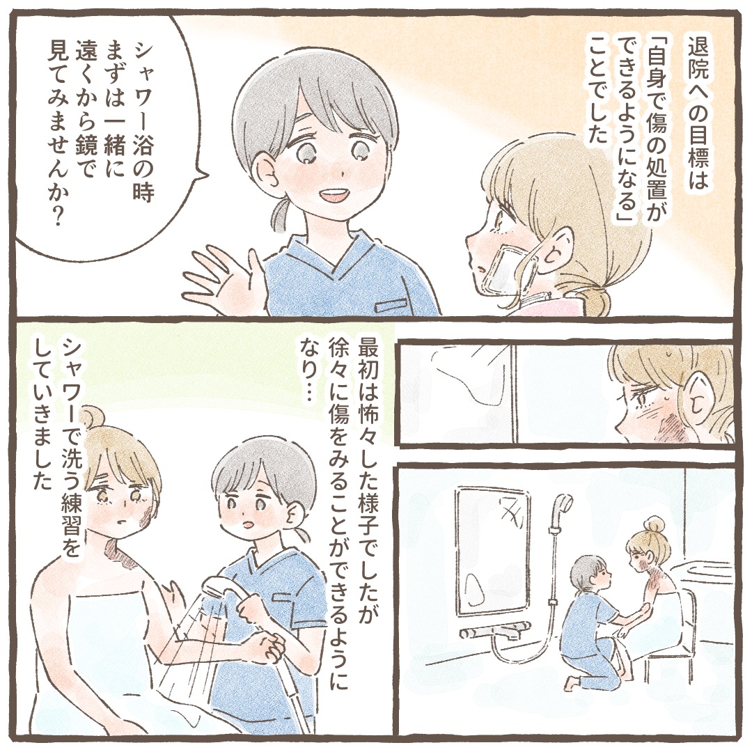 自分で傷の処置ができることを目標に少しずつ進め、シャワー浴でも遠くから鏡で見るなどしていった