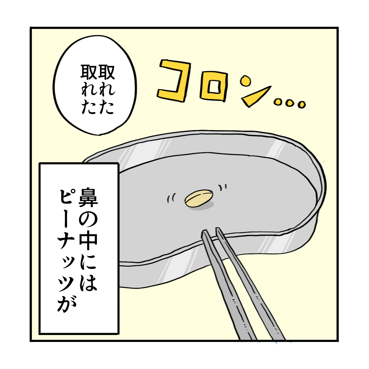 ピンセットでつまんで鼻から出てきたのはピーナッツ